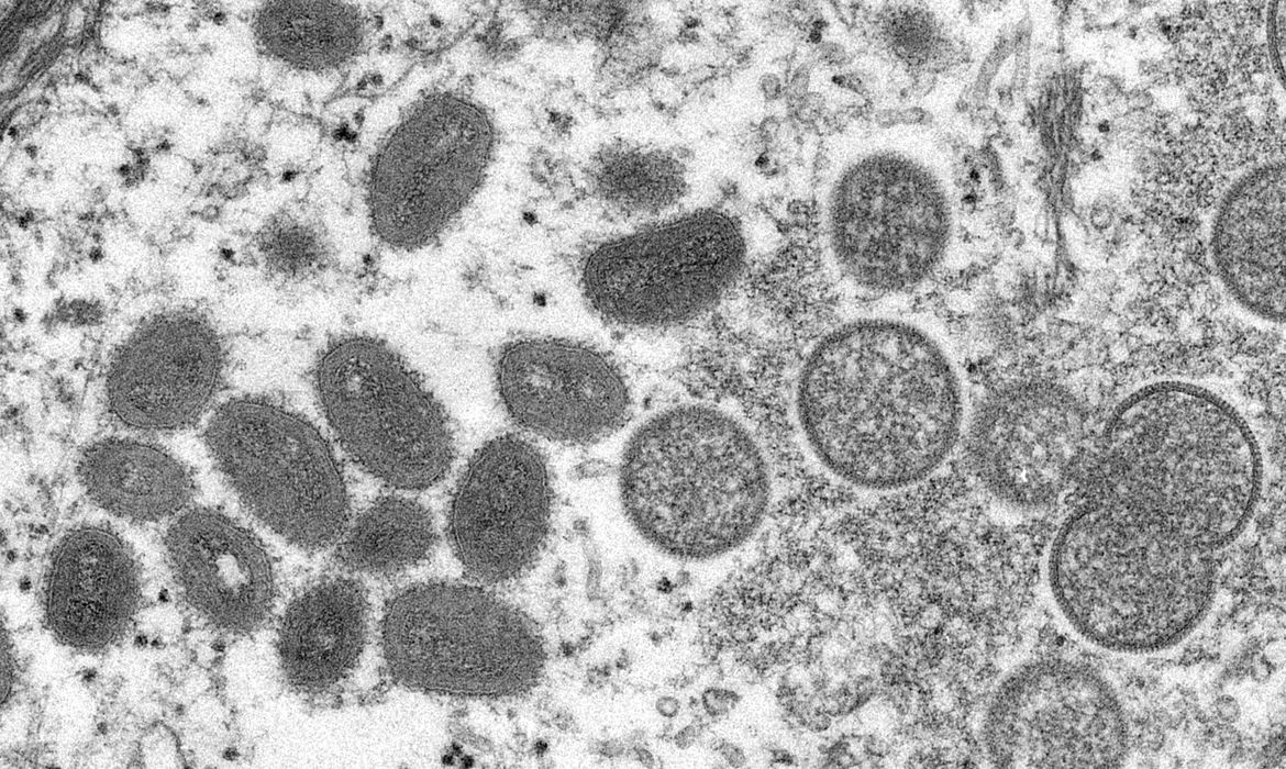 Imagem Brasil registra terceiro caso de varíola dos macacos