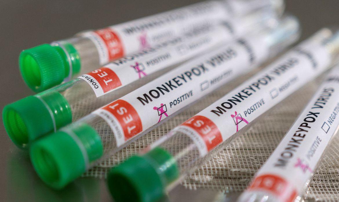 Imagem Ministro diz que Brasil terá antiviral para tratar varíola dos macacos